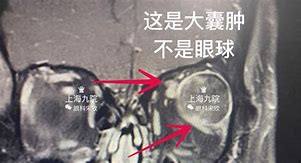 诺曼迪尤吸引眼球长传屡屡造成威胁